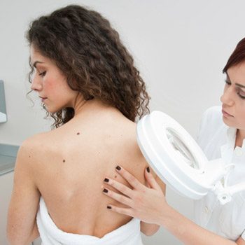 Who performs Mohs surgery close to the San Francisco Area?