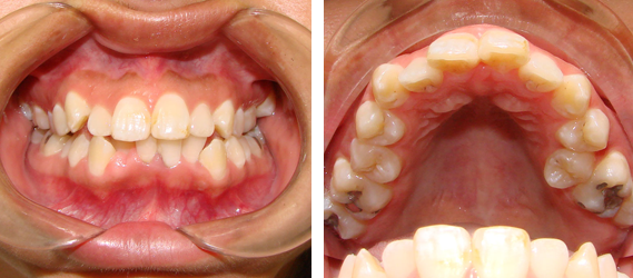 Orthodontics 01