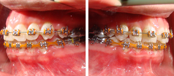 Orthodontics 10
