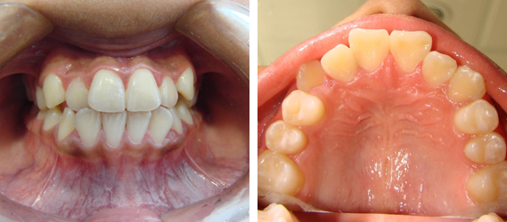 Orthodontics 11