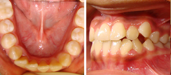 Orthodontics 12
