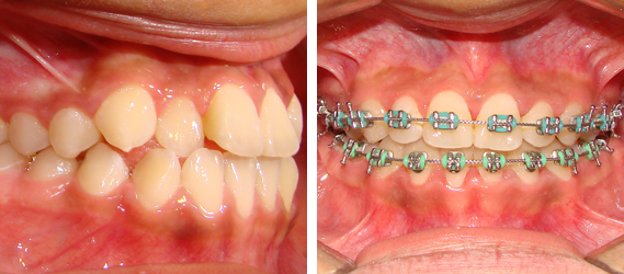 Orthodontics 13