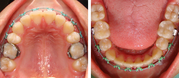 Orthodontics 14
