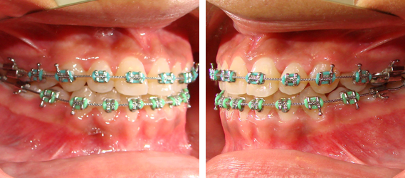 Orthodontics 15