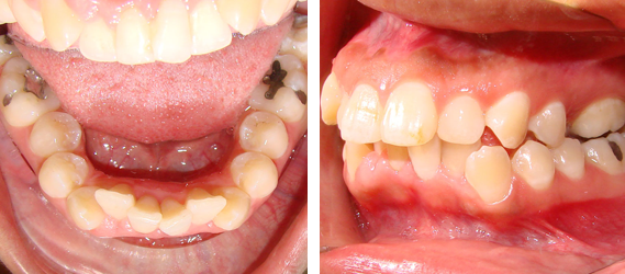Orthodontics 02