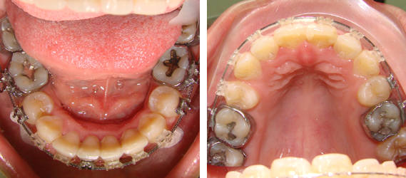Orthodontics 04