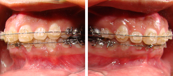 Orthodontics 05