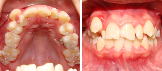 Orthodontics 06