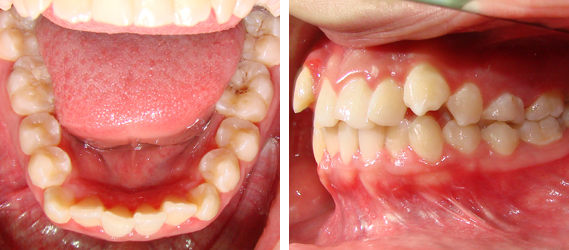Orthodontics 07