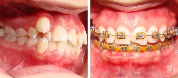 Orthodontics 08