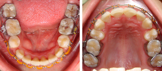 Orthodontics 09