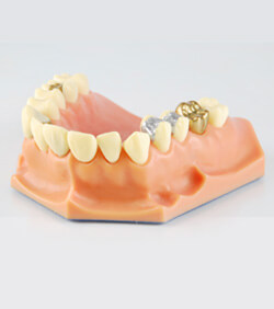 <?php echo $pk;?> - Crowns and Bridges Sample