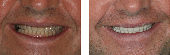 Before After Image case 01