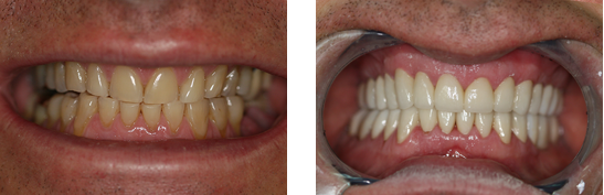 Before After Image case 02