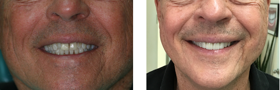 Before After Image case 03
