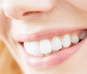 Improve your smile with cosmetic dentistry in Palm Beach Gardens