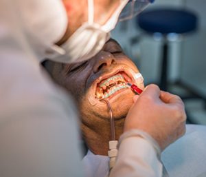 Dentists distinguished from other holistic practitioners in Palm Beach Gardens with safe mercury removal