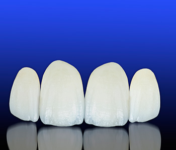 What are the benefits of holistic dentistry in West Palm Beach?