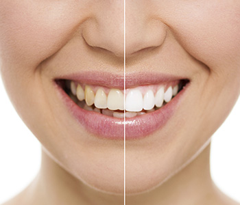 Where to find an experienced holistic dentist in the West Palm Beach area