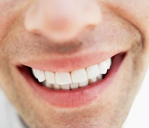 Where can I get safe dental cavity fillings near me in the Palm Beach Gardens area?