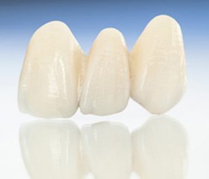How ozone therapy and restorative dentistry work hand in hand at West Palm Beach dental practice