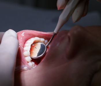 cost effective gum disease treatment from expert dentist in West Palm Beach area