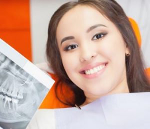 What kind of implants does West Palm Beach area dentists recommend?