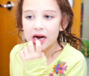What treatment might West Palm Beach patients need for periodontitis?