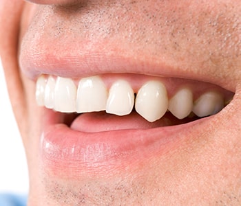 Dr Munira Lokhandwala, Starbrite Dental, Providing dentist in san jose