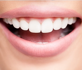 Dr Munira Lokhandwala, Starbrite Dental, Providing dentistry near san jose