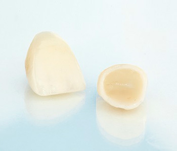 Dr Munira Lokhandwala, Starbrite Dental, Providing Cosmetic Dentistry