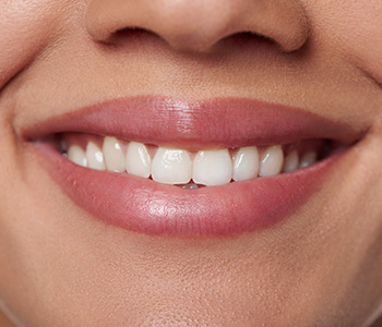 Dr Munira Lokhandwala, Starbrite Dental, Providing Cosmetic Dentistry