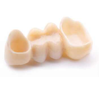 Dr Munira Lokhandwala, Starbrite Dental, Providing dental implants