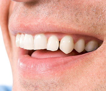Dr Munira Lokhandwala, Starbrite Dental, Providing Good Cosmetic Dental Service
