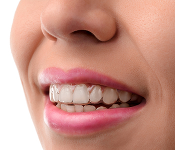 Dr Munira Lokhandwala, Starbrite Dental, Dental medical care. Invisible braces. Silicone trainer