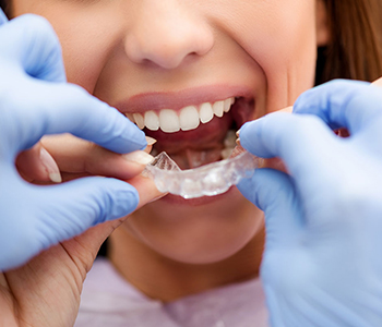 Dr Munira Lokhandwala, Starbrite Dental, Providing Invisible Braces