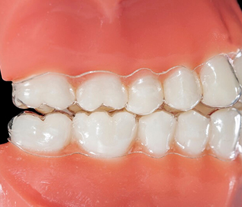 Dr Munira Lokhandwala, Starbrite Dental, Providing Invisalign