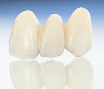 Dr Munira Lokhandwala, Starbrite Dental, Providing porcelain Veneers in Fremont
