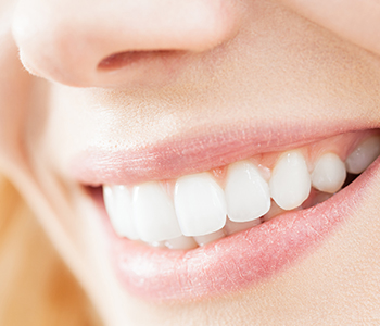 Dr Munira Lokhandwala, Starbrite Dental, Providing Teeth Whitening Treatment