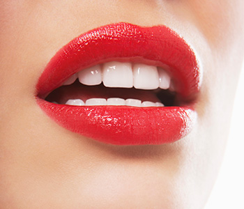 Dr Munira Lokhandwala, Starbrite Dental, Providing Tooth veneers san jose area