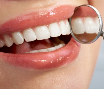 Dr Munira Lokhandwala, Starbrite Dental, Providing upper denture