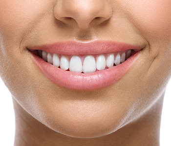 Dr Munira Lokhandwala, Starbrite Dental, Providing Zoom in San Jose