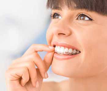 Women, men, and teens who are bothered by the appearance of misaligned or crooked teeth should consider Invisalign treatment in Fremont CA with Dr. Munira Lokhandwala at StarBrite Dental.