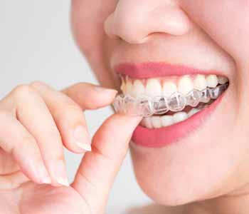 Dr. Munira Lokhandwala encourages patients to wear their trays at least 20 hours a day, only removing them for cleaning, brushing, flossing, or eating. This ensures that patients achieve the results they desire.