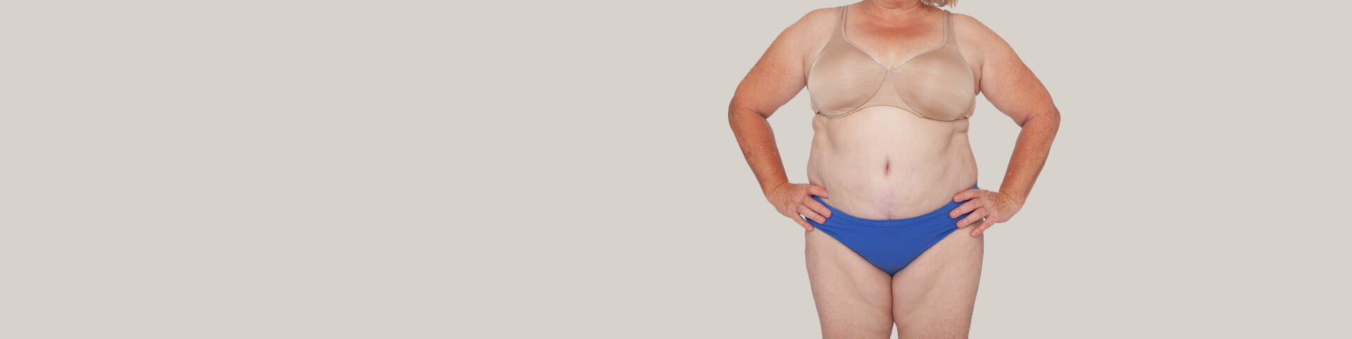 Full body front view of woman with weight gain after Mommy Makeover