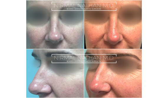 Face before after 8