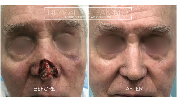 Face before after 6