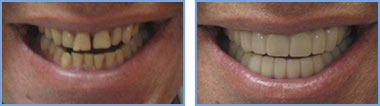 <?php echo $pk;?> - Before and After - Case 03