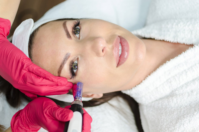 Diminish the appearance of acne scars without laser treatment in the Silver Spring area