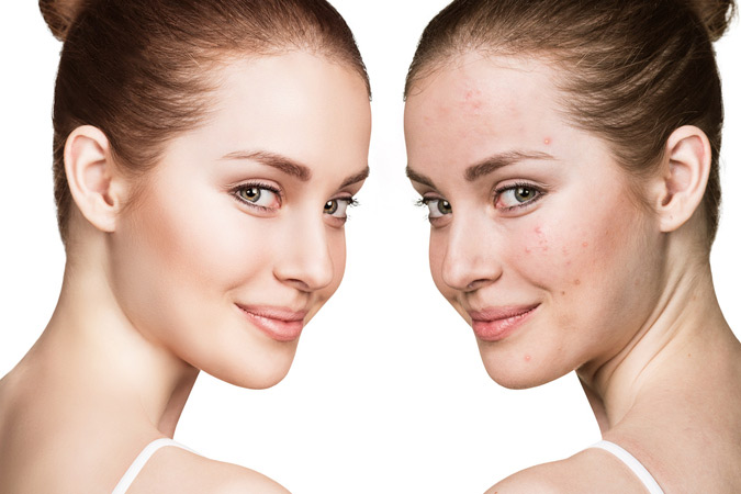 Anti-aging treatments available in Rockville area dermatology